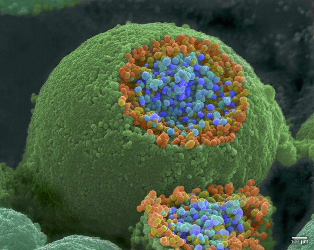 Real time visualisation of electricity in the brain. Credit: neuroscape lab