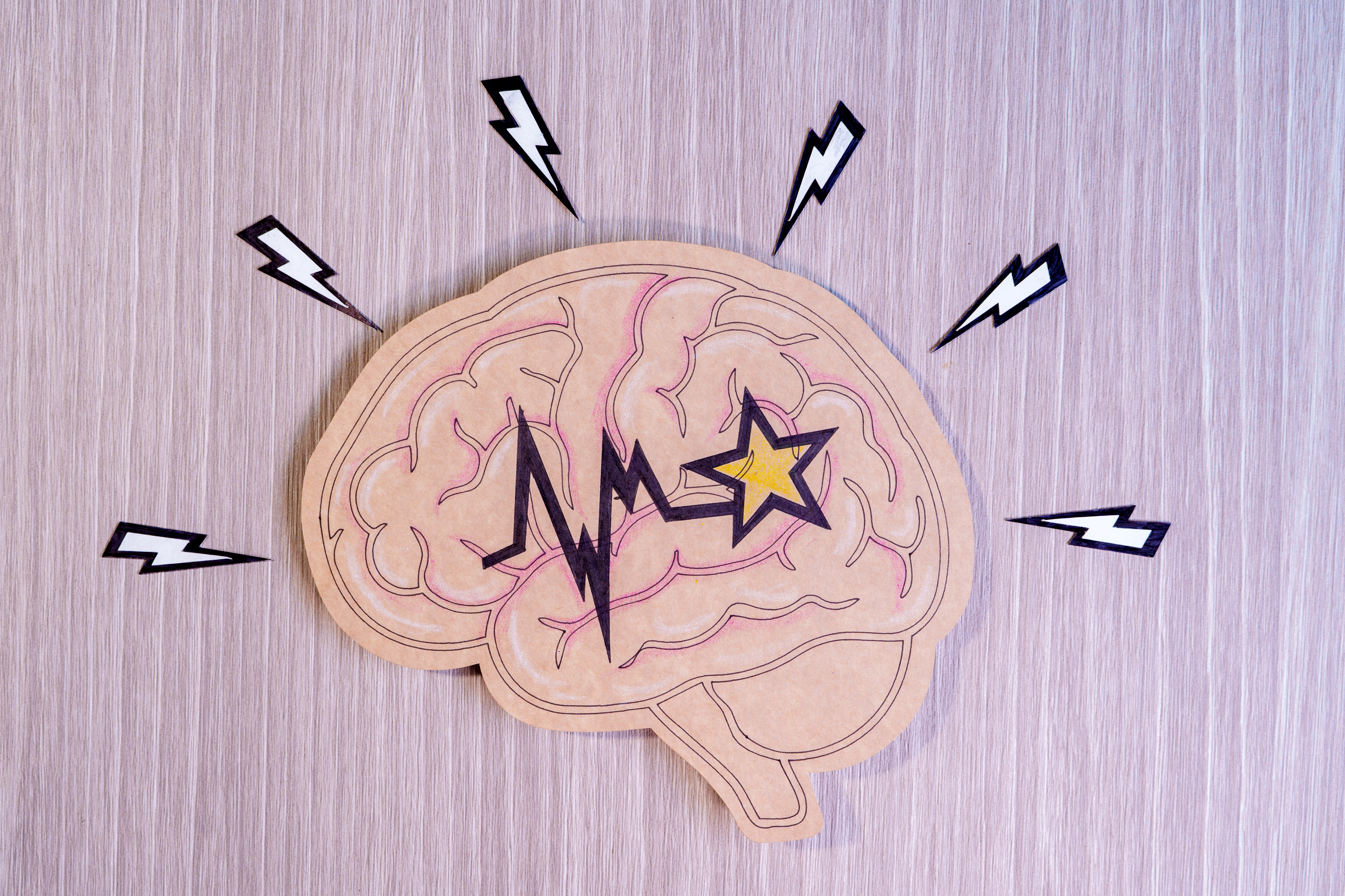 Rewiring the brain without surgery: how TMS actually works